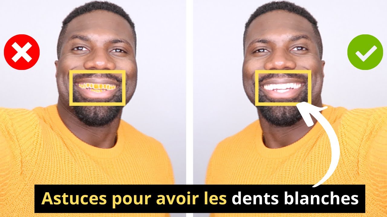 Comment Avoir Les DENTS BLANCHES | BLANCHIR SES DENTS