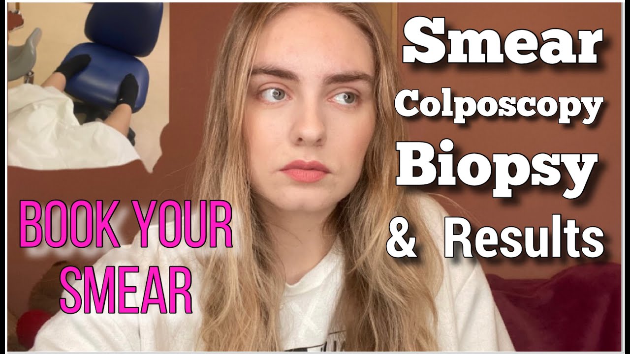 SMEAR STORY: COLPOSCOPY, BIOPSY & RESULTS - WHAT I WISH I HAD BEEN TOLD
