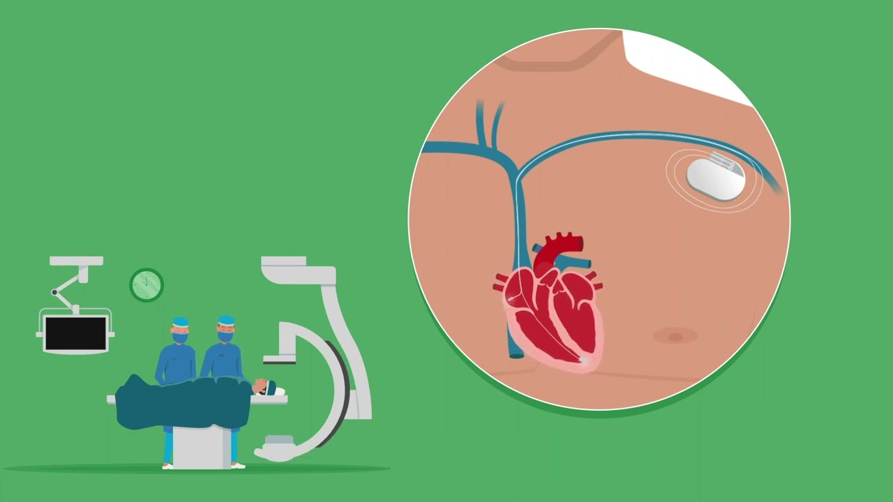 Hoe gaat het plaatsen van een pacemaker of ICD?