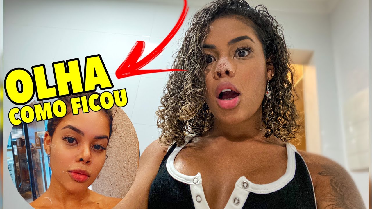 VI MEU NARIZ PELA PRIMEIRA VEZ DEPOIS DA RINOPLASTIA!