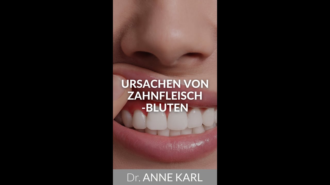 Was gegen Zahnfleischbluten tun? Ursachen von Zahnfleischbluten!  | Dr. Anne Karl