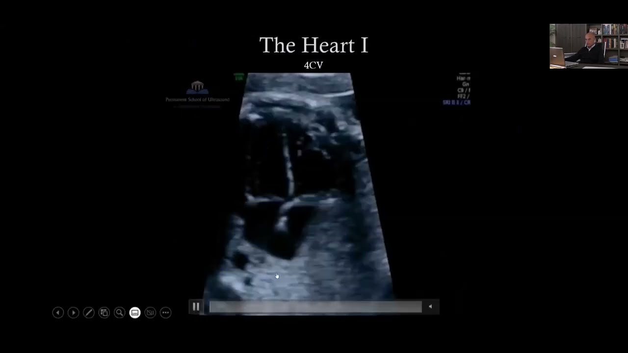 How to scan the fetal heart: the basics you should know.