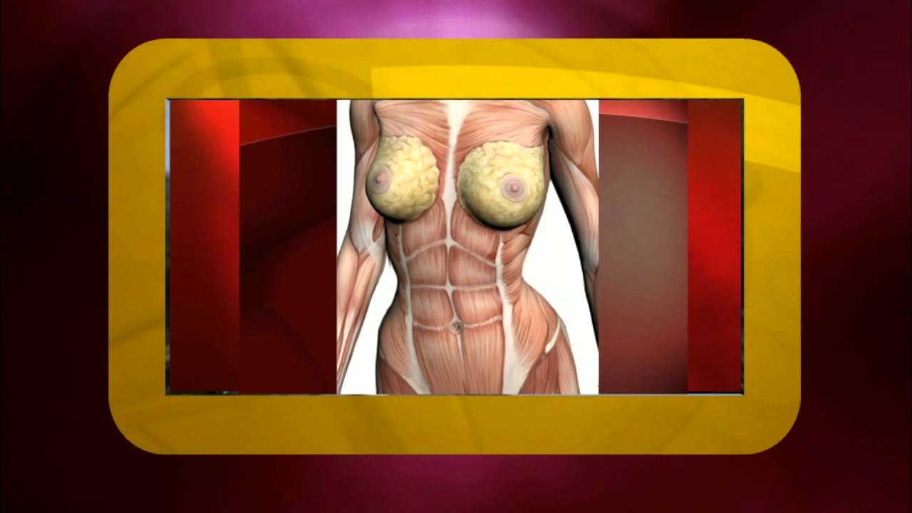 Dr. Cortes's Tummy tuck technique