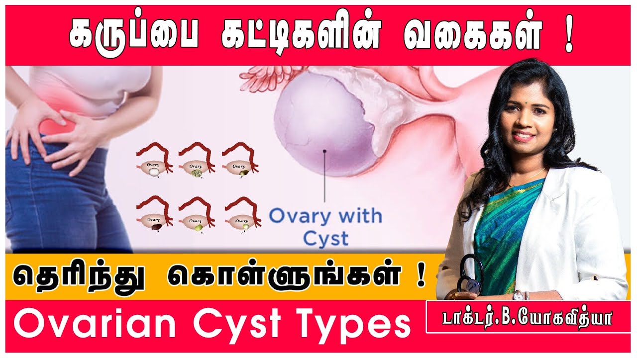 Ovarian Cyst ! | கருப்பை நீர்க்கட்டிகள் ! | Types Of Cyst ! | Explained By Dr.B.Yoga Vidhya