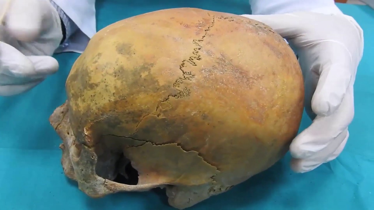 Anatomi Kemikler Neurocranium Kemikleri|Os Frontale+Sphenoidale+Ethmoidale Anatomisi (Basit Anlatım)