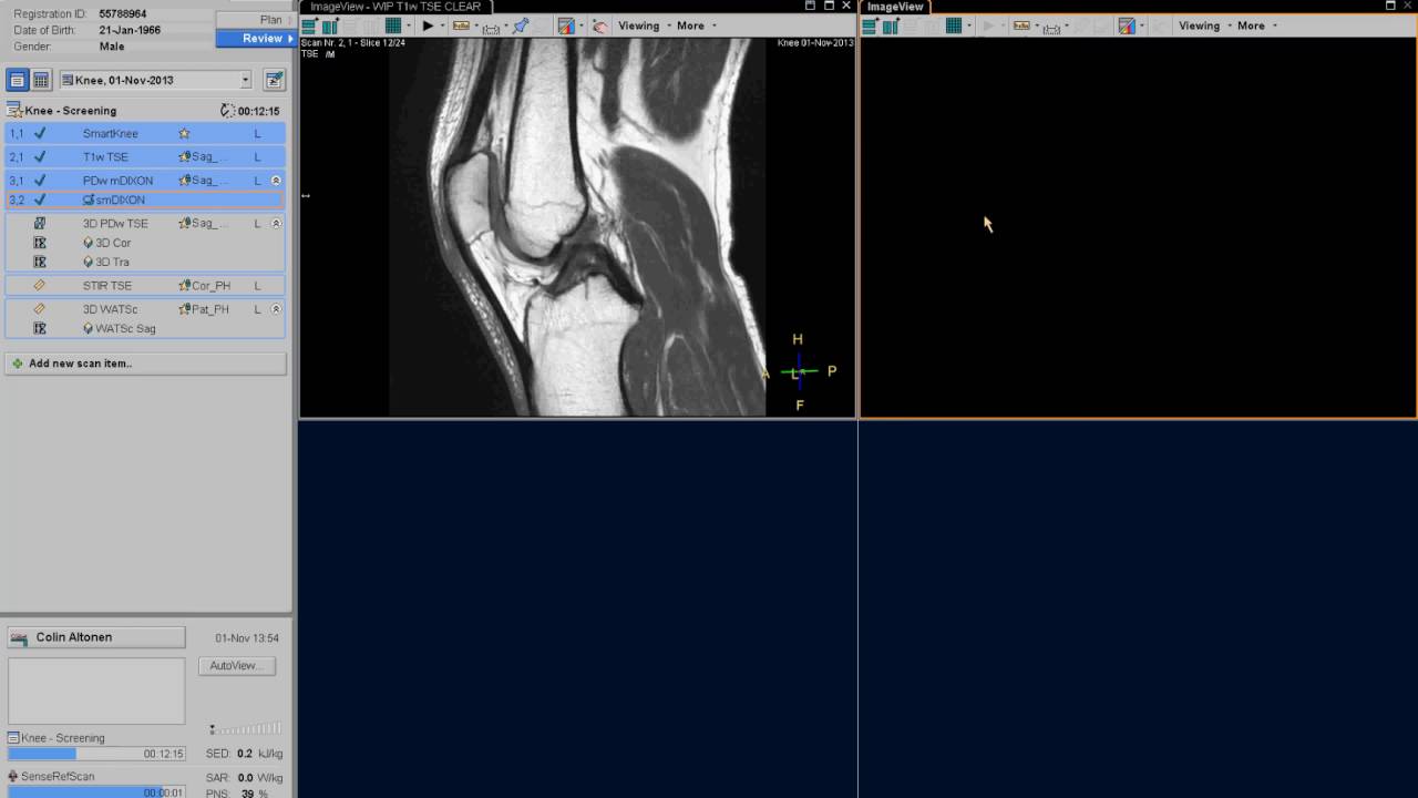 Clinical applications video - Ingenia Knee imaging
