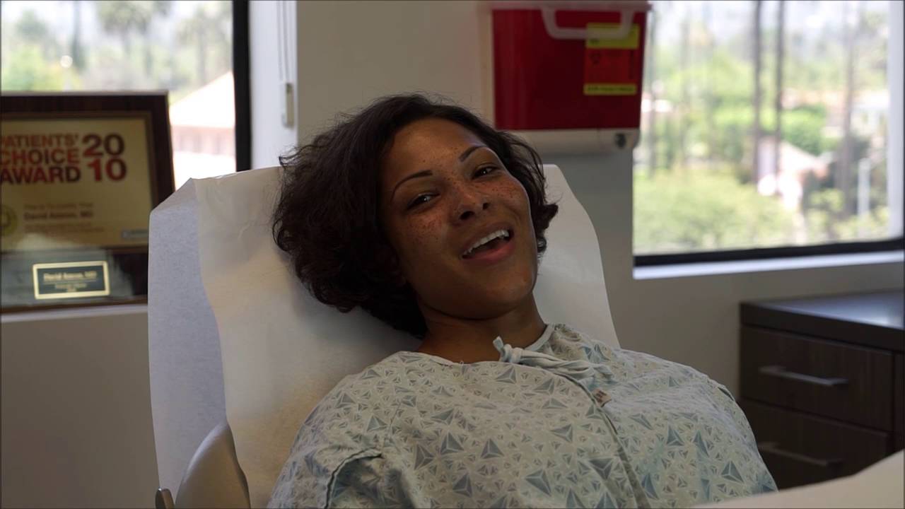 Dr. Ahdout performs ThermiVa vaginal rejuvenation