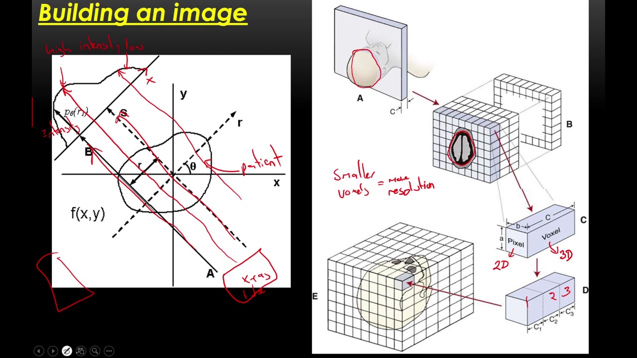CIE A-Level Physics: CAT Scanning