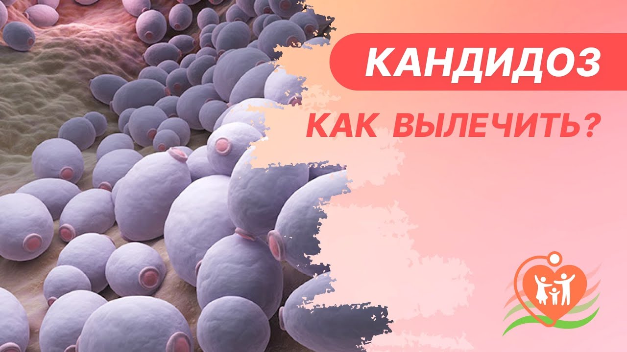 🧼  Кандидоз - как вылечить?