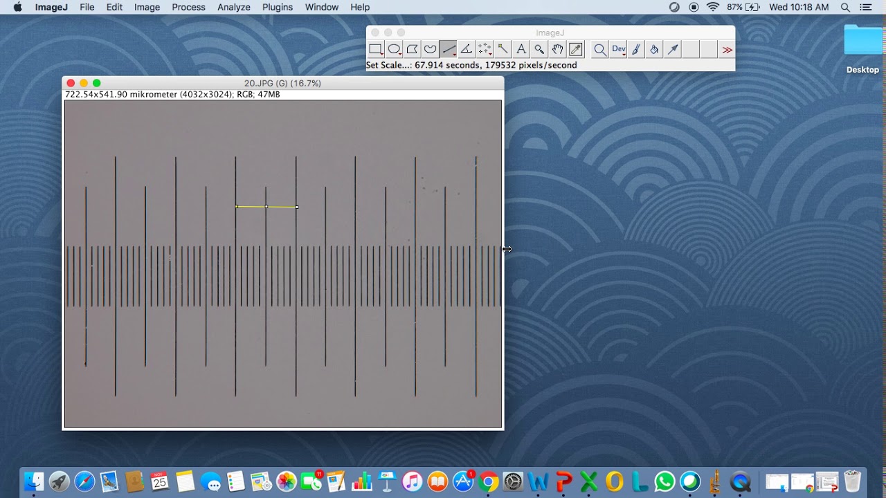 Pengukuran Diameter Vessel menggunakan ImageJ
