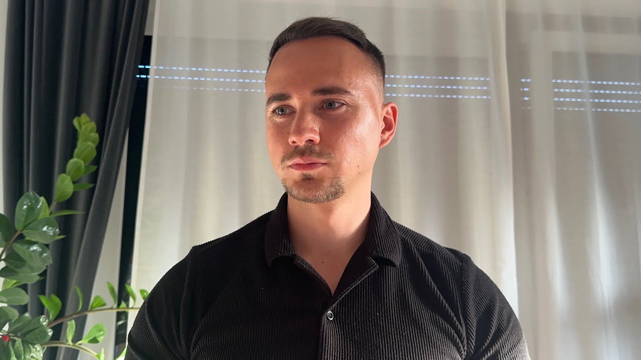 MONAT 6! So sieht es aktuell aus! HAARTRANSPLANTATION ELITHAIR!