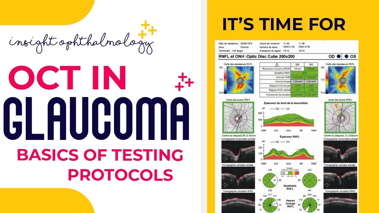 HOW TO READ AN OCT PRINTOUT IN GLAUCOMA || BASIC TESTING PROTOCOLS|| ( RNFL, ONH & MACULAR ANALYSIS}