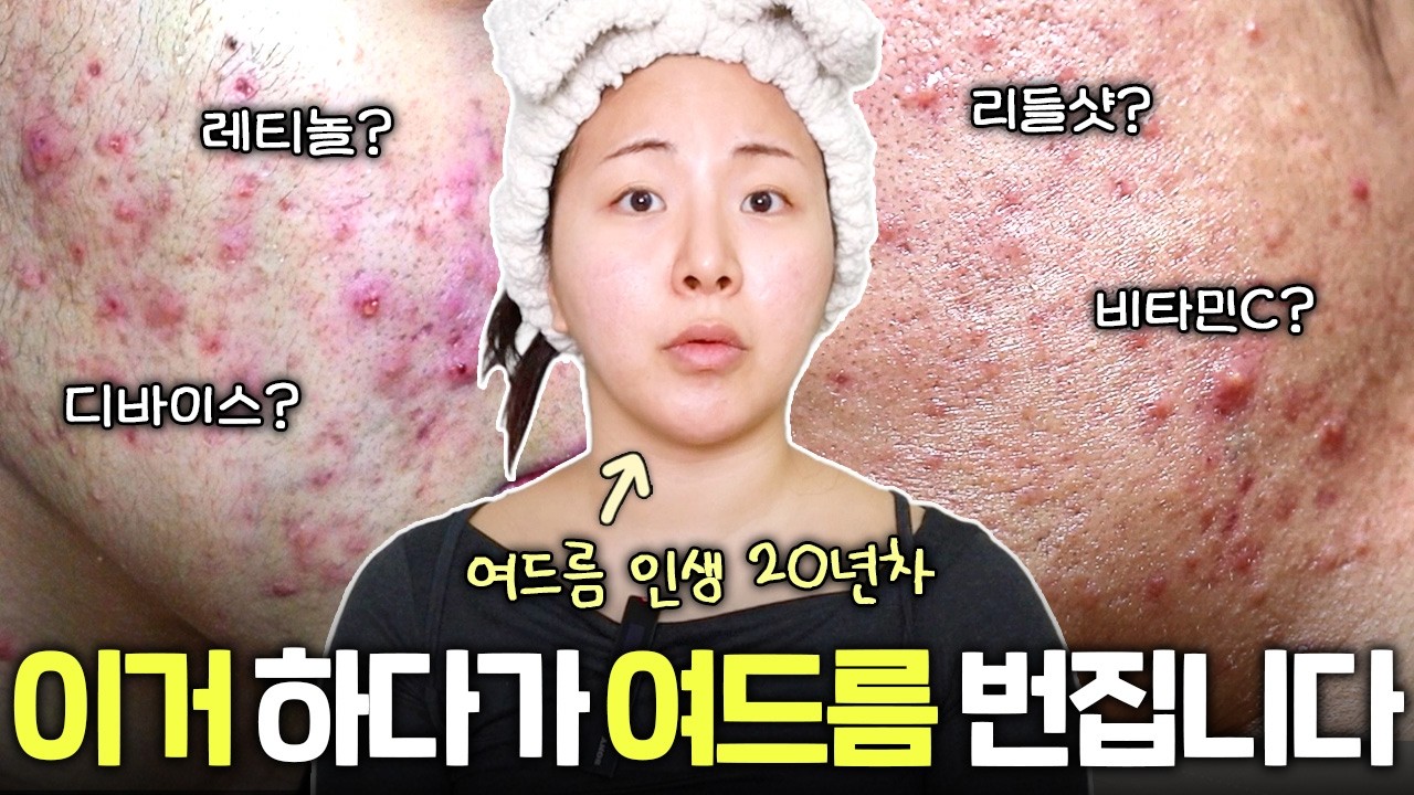(분노주의)피부 좋아진다고요...? 이 5가지는 제발 절대 하지 마세요
