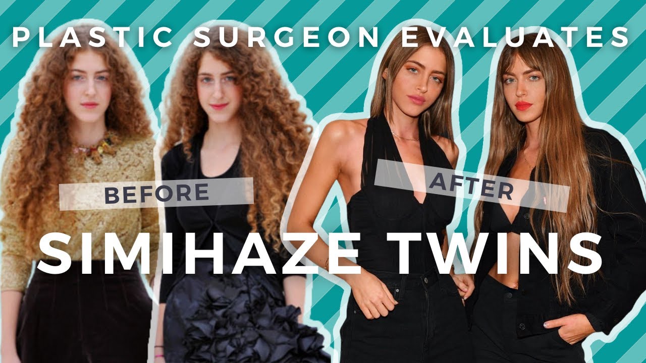 SimiHaze Twins Plastic Surgery Transformation