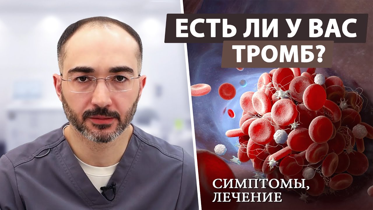 Как заподозрить у себя тромбоз и что потом делать?