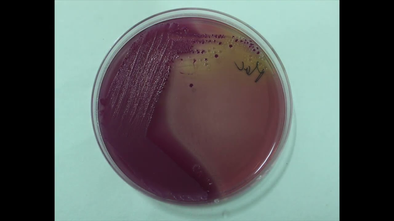 Análisis microbiológico de heces mediante coprocultivo