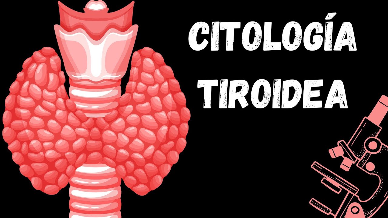 Citología tiroidea