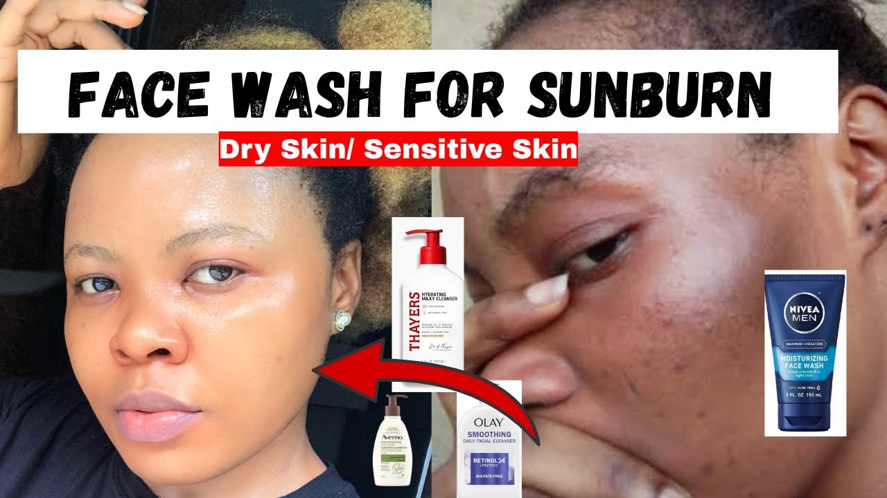 Face Wash For SUNBURN Skin And DRY Skin