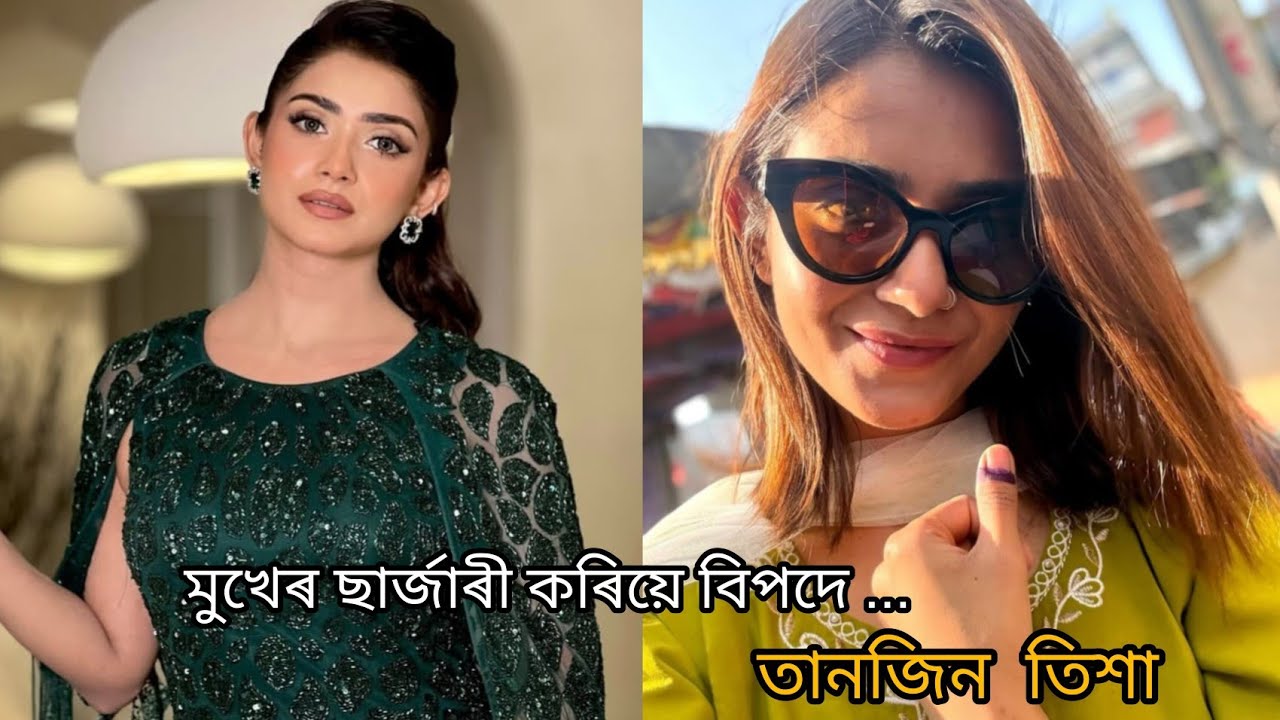 হঠাৎ কি হলো তানজিন তিশাৰ! Bengali actress tanjin tisha's face is changed. Is she done filler?