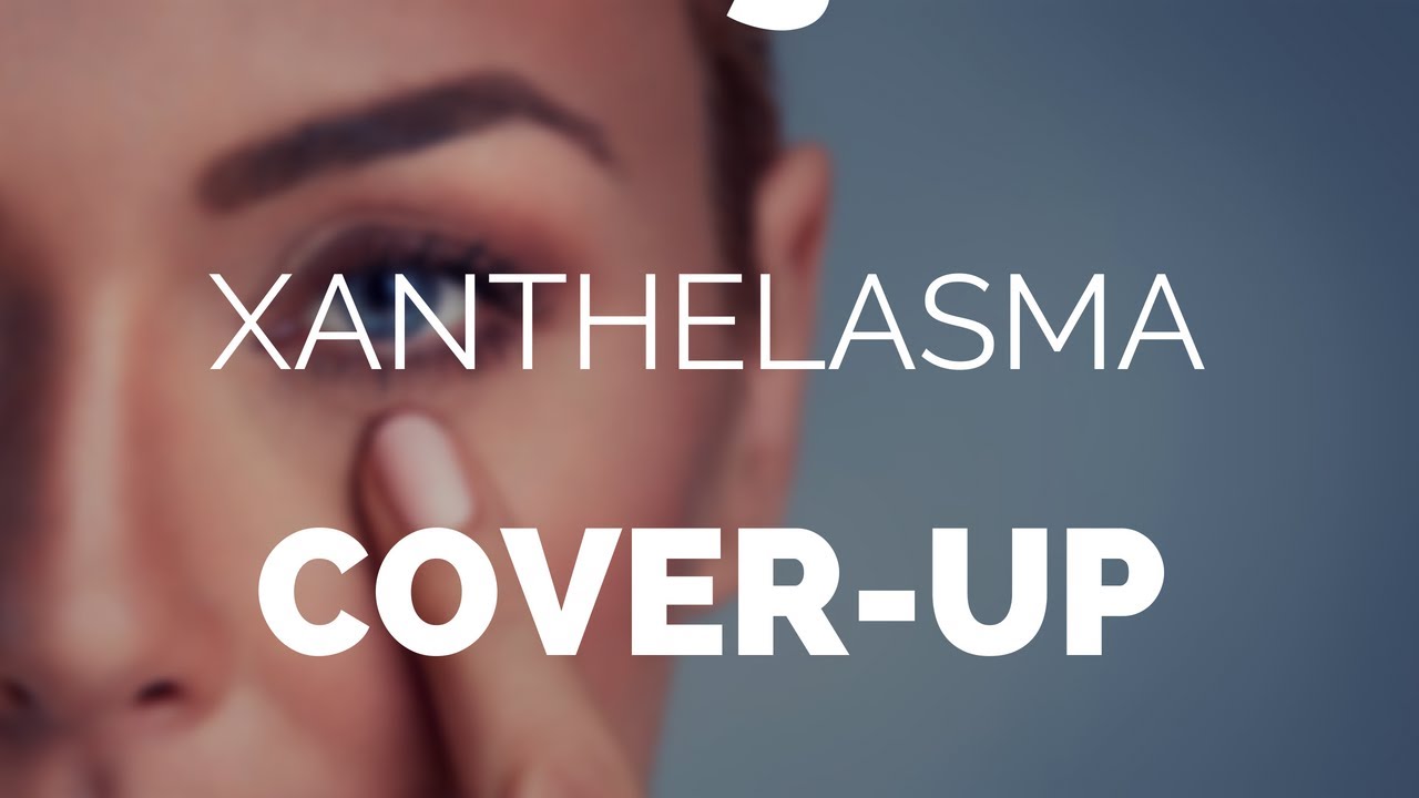 Xanthelasma cover up, or why not just remove them!