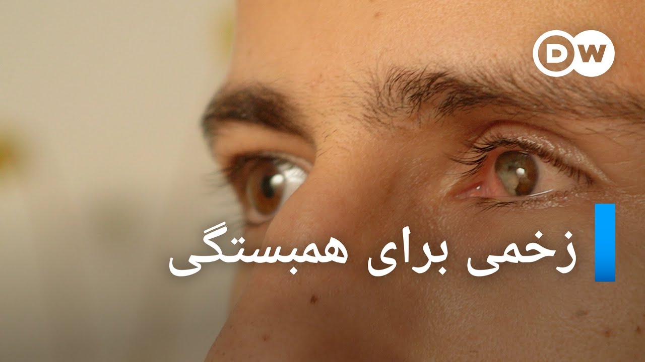 زخمی برای همبستگی