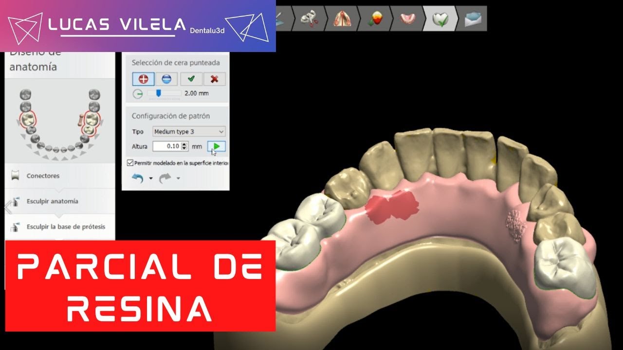 PARCIAL DE RESINA / 3SHAPE