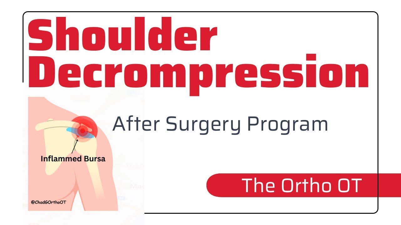 Shoulder Subacromial Decompression Program 