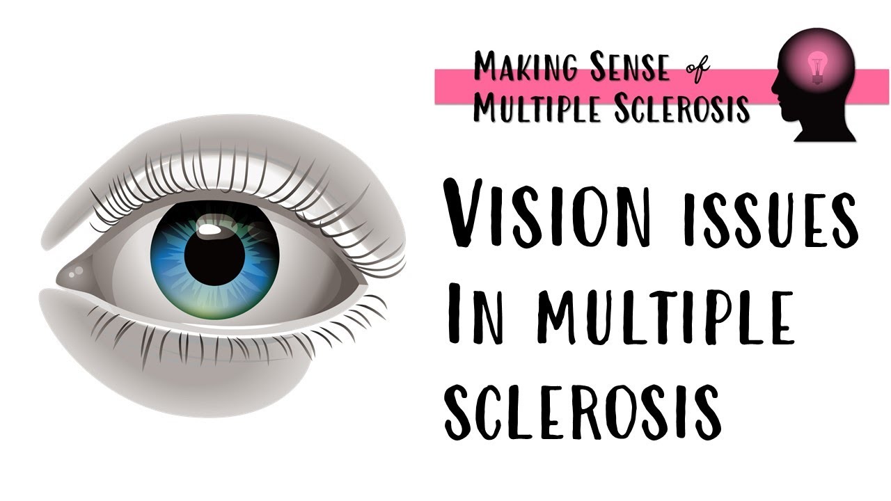 Coping with Vision Issues in MS