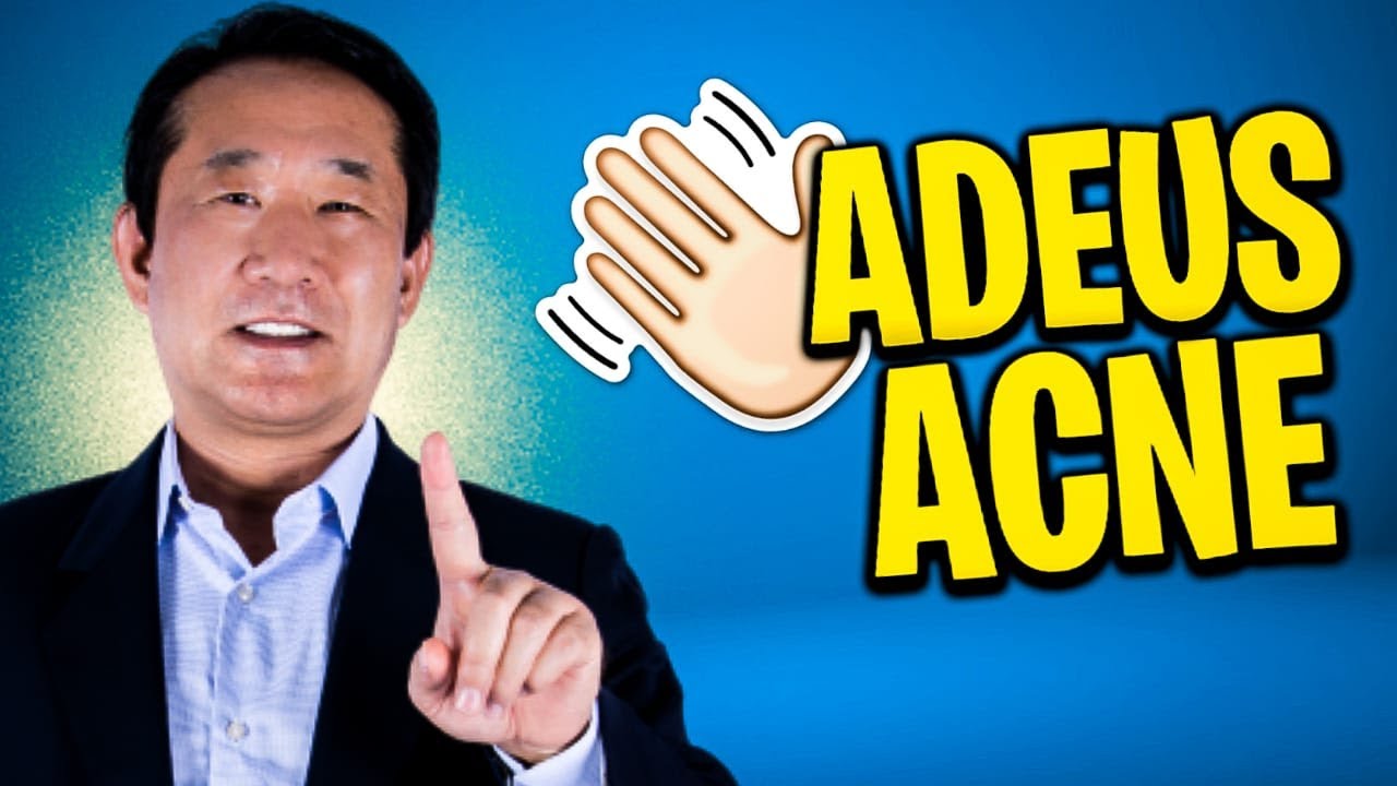 Acne e seus remédios caseiros