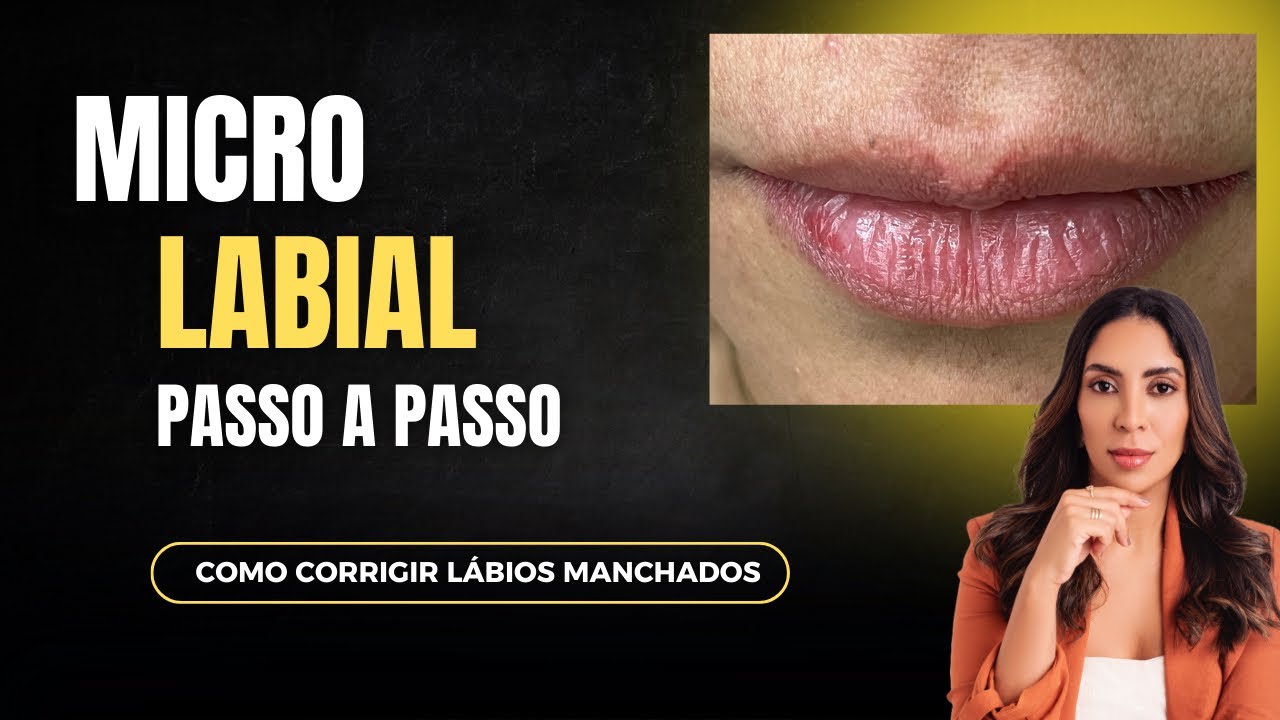 Micro Labial - Como corrigir lábios manchados
