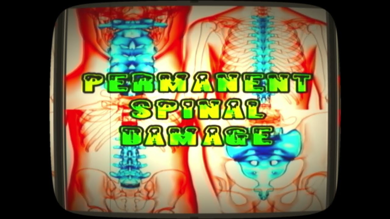 Vinesauce - Permanent Spine Damage (Rock Remix)