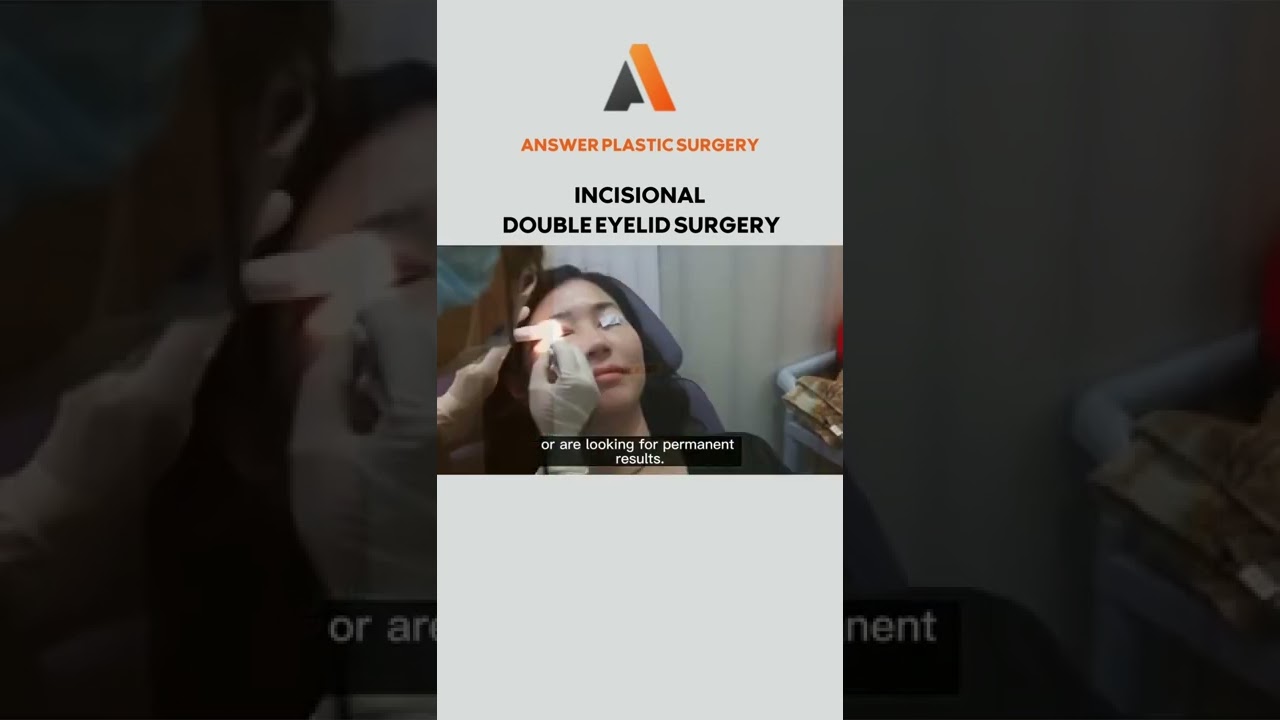 Incisional Double Eyelid Surgery | Answer Plastic Surgery 