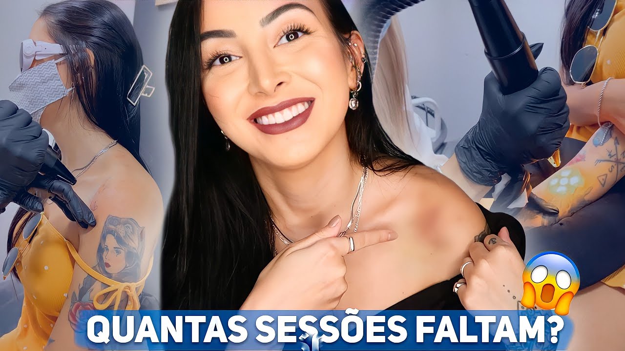 COMO ANDA A REMOÇÃO DA MINHA TATUAGEM - ATUALIZAÇÃO