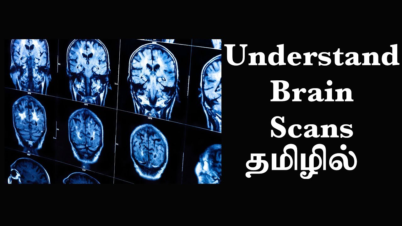தொழில்நுட்ப்பத்தின்  மூலம் மூளையைப்புரிந்துகொள்ளும் முறை (Ep8) Basic Psychology in Tamil
