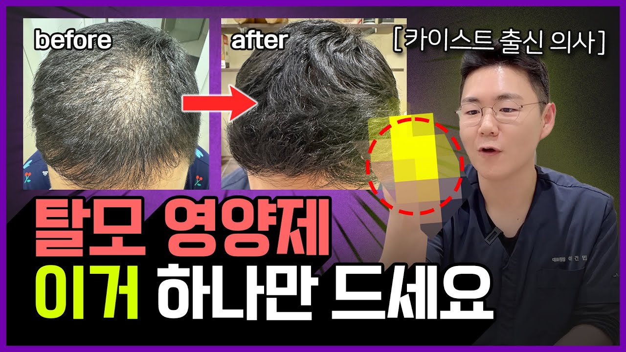 탈모 약 대신 '이걸' 먹으면 머리 숱이 풍성해진다!?