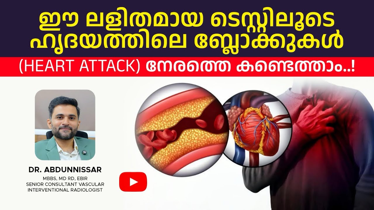 ഈ ലളിതമായ ടെസ്റ്റിലൂടെ ഹൃദയത്തിലെ ബ്ലോക്കുകൾ(Heart Attack)  നേരത്തെ കണ്ടെത്താം..#viralvideo