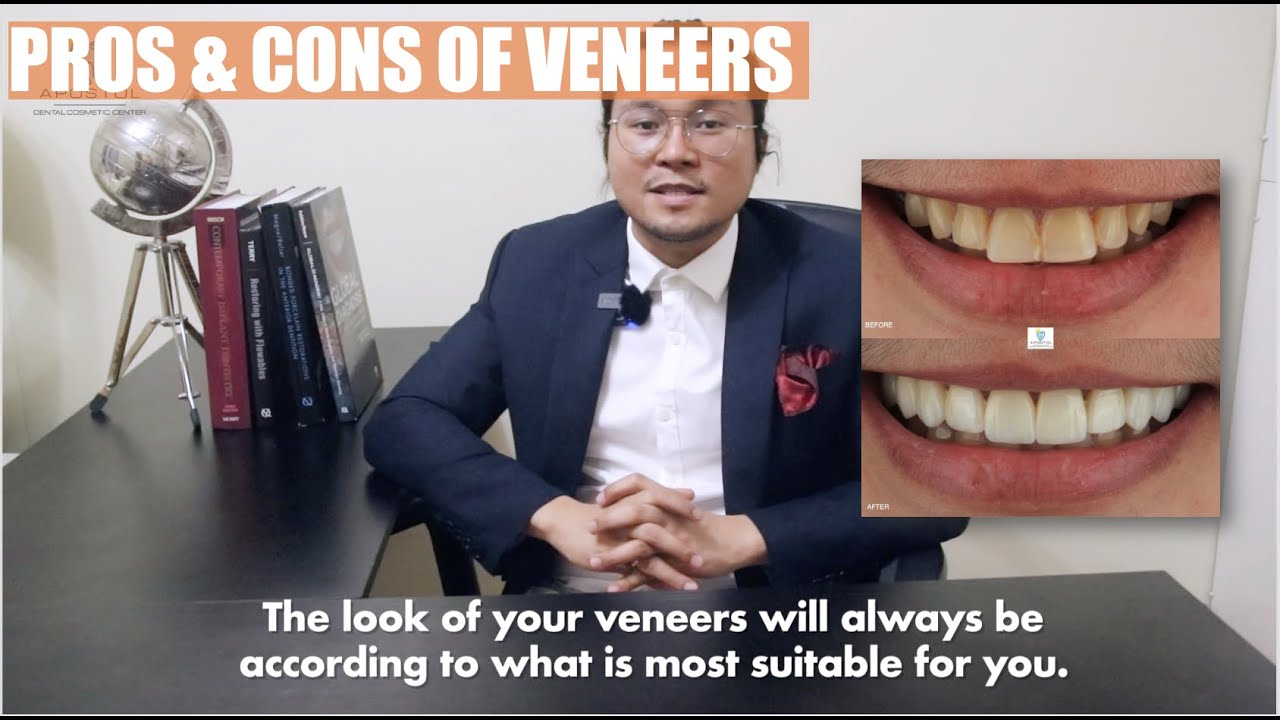 Виниры: за и против | Apostol Dental Philippines