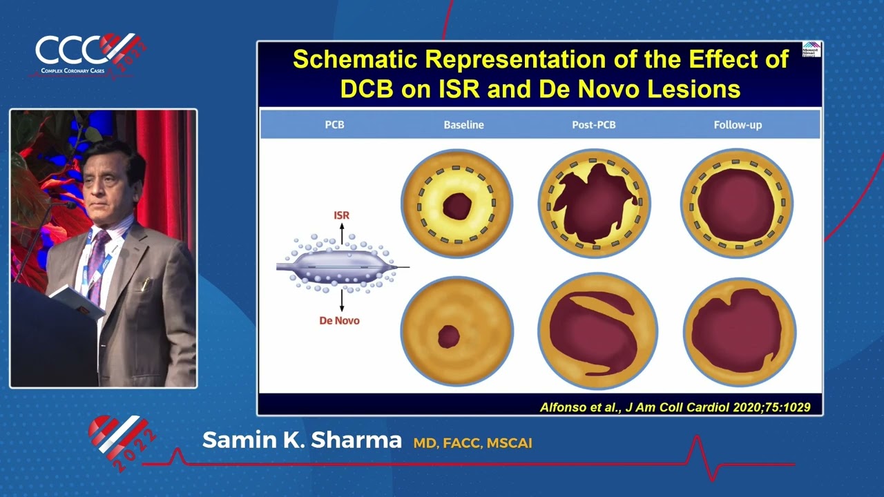 Top Ten Advances of Interventional Cardiology 2021 2022 - Samin K  Sharma, MD