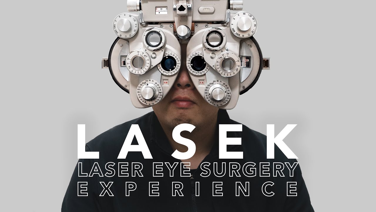 My LASEK Laser Eye Surgery Experience
