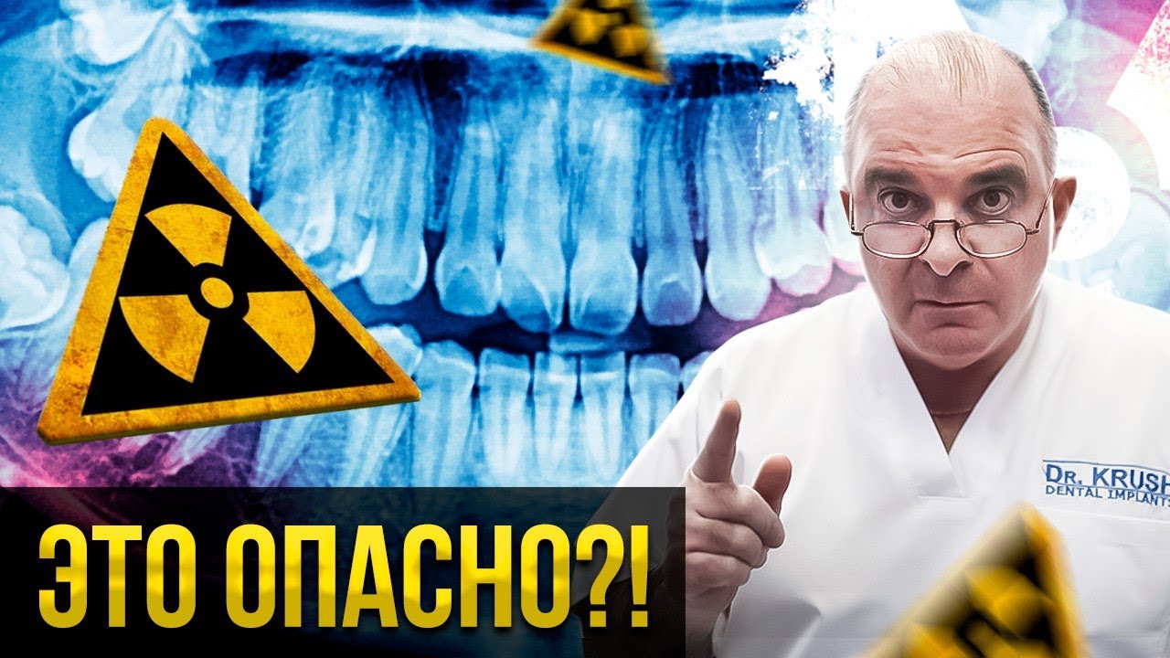 ОПАСНО ли делать РЕНТГЕН ЗУБОВ? Смотрите подробности...