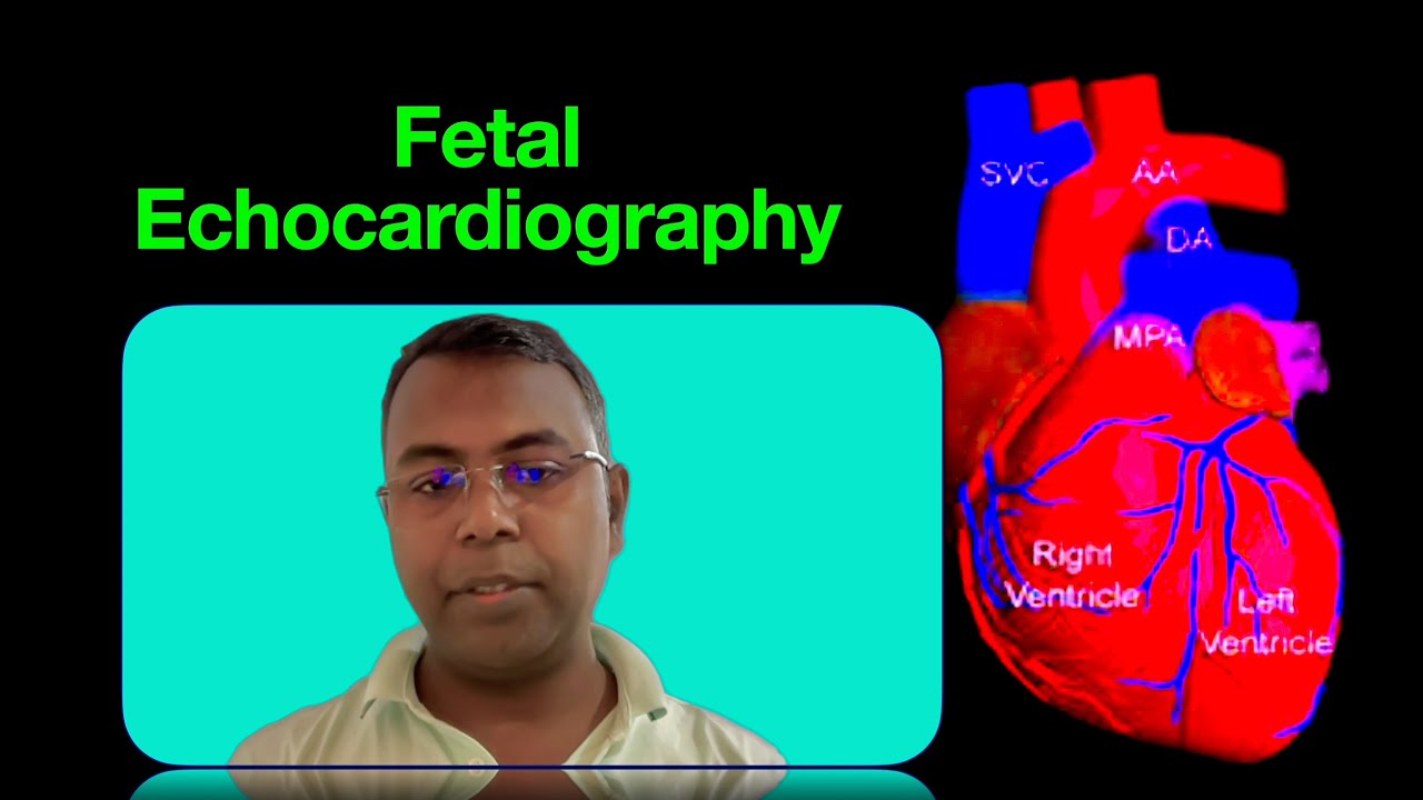 FETAL ECHO ILLUSTRATED
