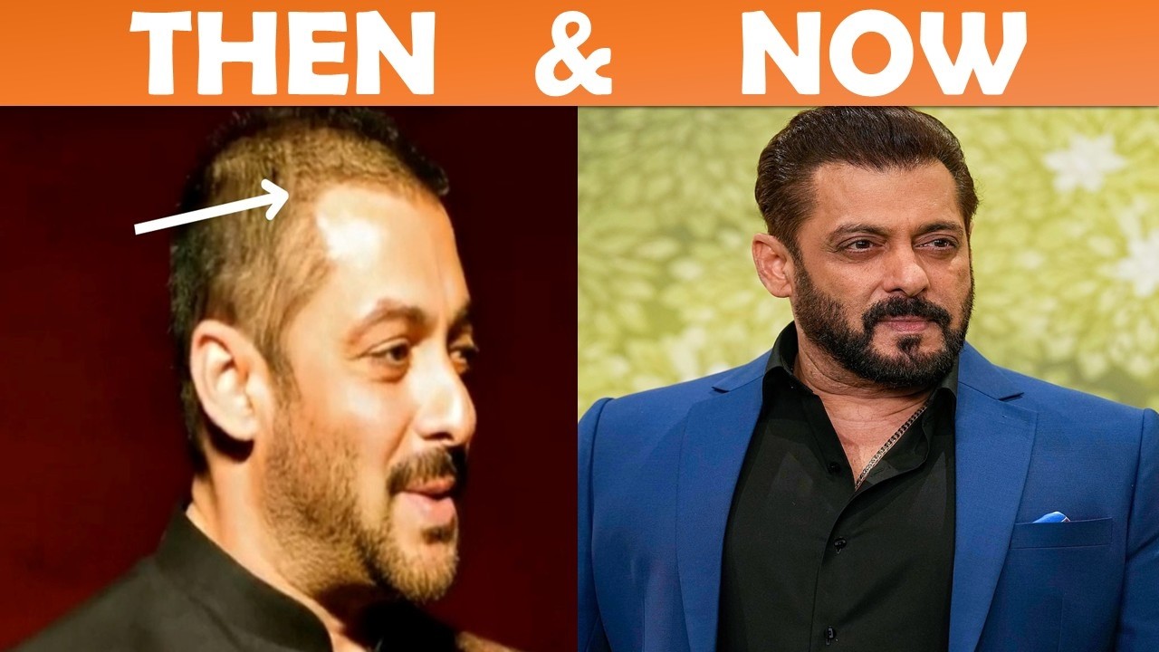 Bollywood Top Actors Shocking Transformation Before And After Plastic Surgery!