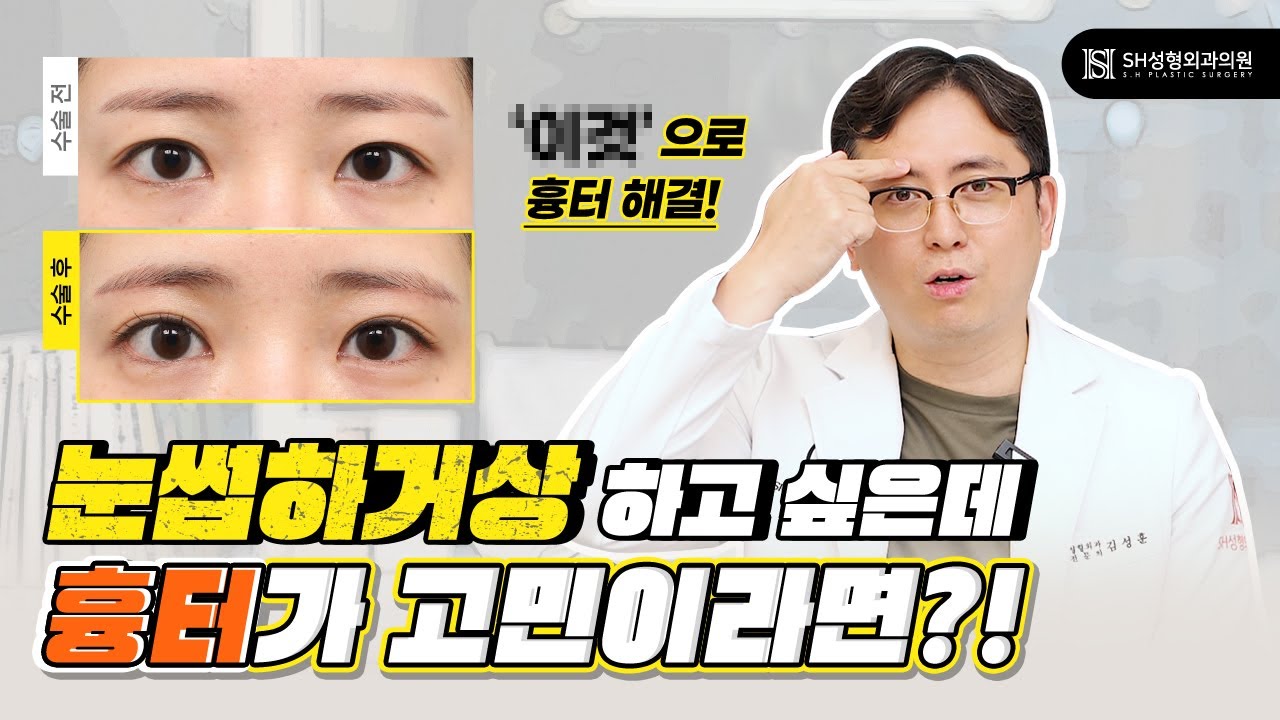눈썹하거상 흉터?! 이렇게 해결합니다.