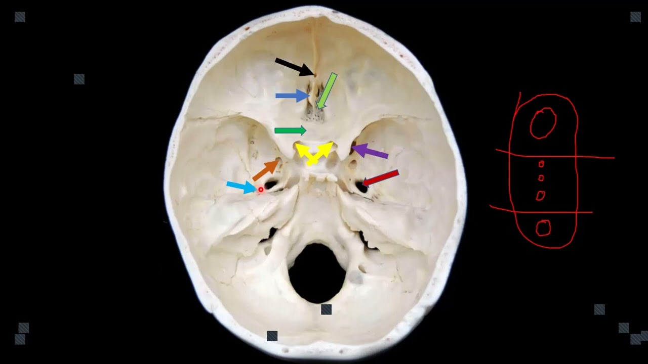 CRANIAL CAVITY AND SKULL FORAMINA