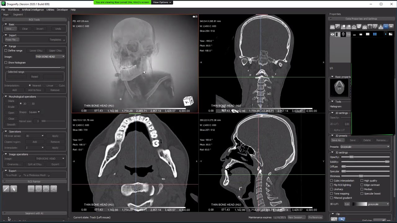 Using the Segmentation Wizard tool to train a Deep Learning model for your image segmentation tasks.