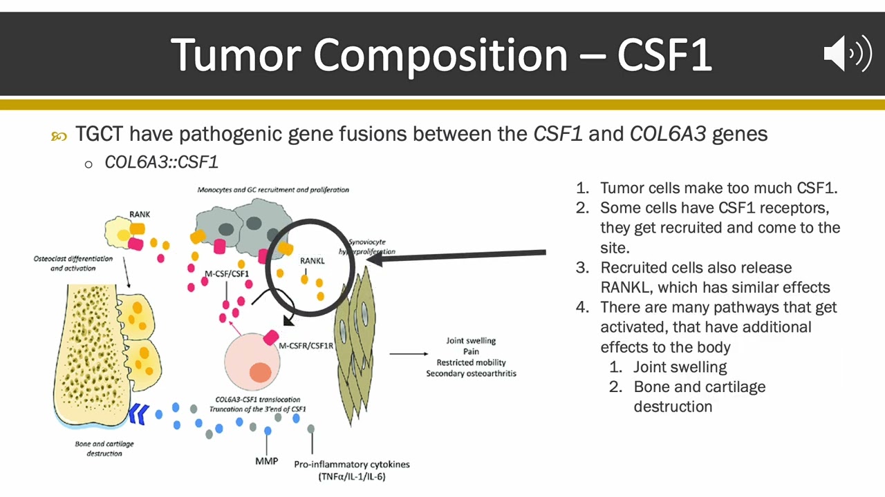 From Cells to Tumors: The Pathology of TGCT