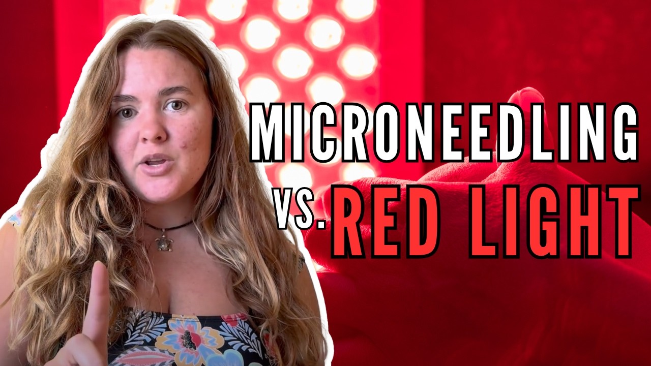 Microneedling or Red Light Therapy? (I Tried Both for Acne Scars)
