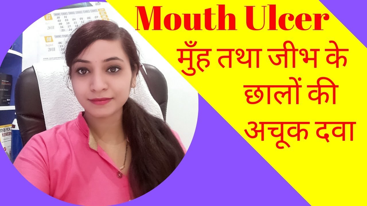 Mouth ulcer homeopathic medicine | Tongue ulcer homeopathic medicine | home remedy & treatment