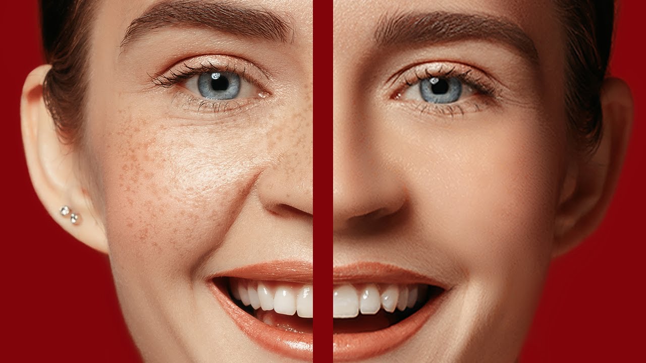 How to Remove Freckles on Face | Photoshop Tutorial