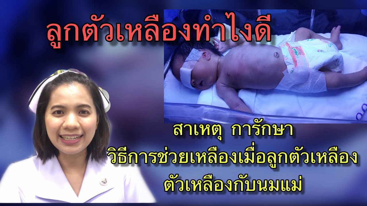 #ลูกตัวเหลือง ทำยังไงดี สาเหตุ การรักษา วิธีช่วยเหลือเมื่อลูกตัวเหลือง #ตัวเหลืองกับนมแม่ #ลูกส่องไฟ